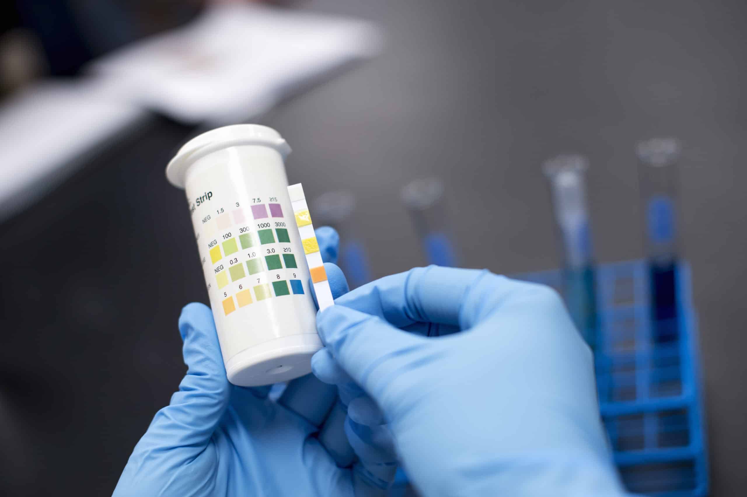 Narkotikatest for privatpersoner – trygg og konfidensiell hjelp